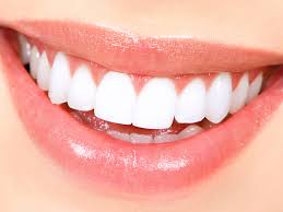 Teeth Whitening the colony