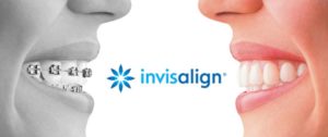Invisalign Specialist Near Lewisville