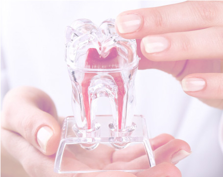 root canal therapy lewisville