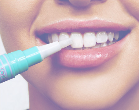 teeth whitening the colony