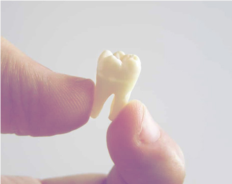 Full Mouth Restorations Lewsiville