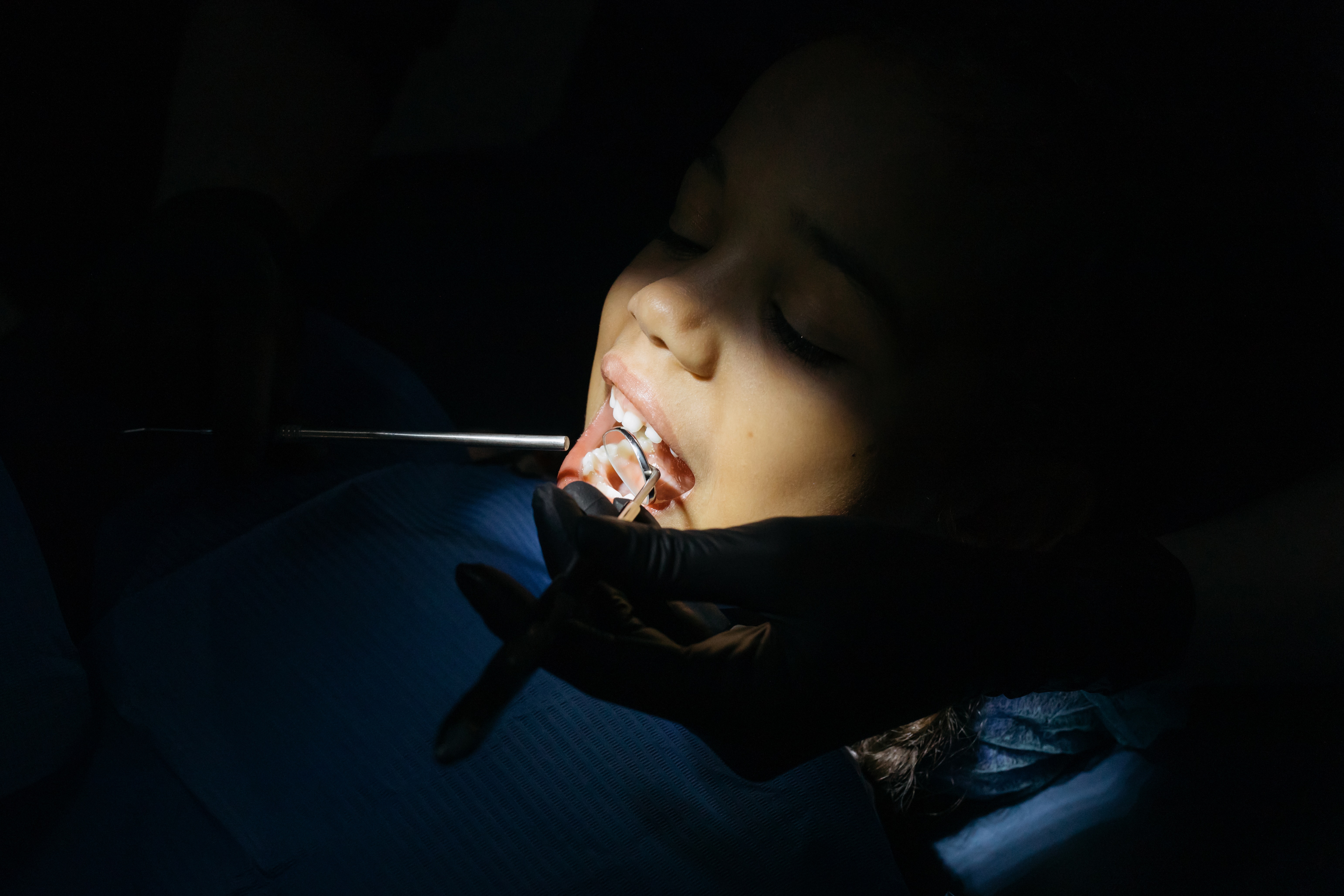 What is Dental Phobia and Dental Anxiety?