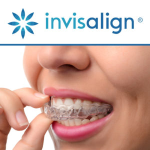 invisalign