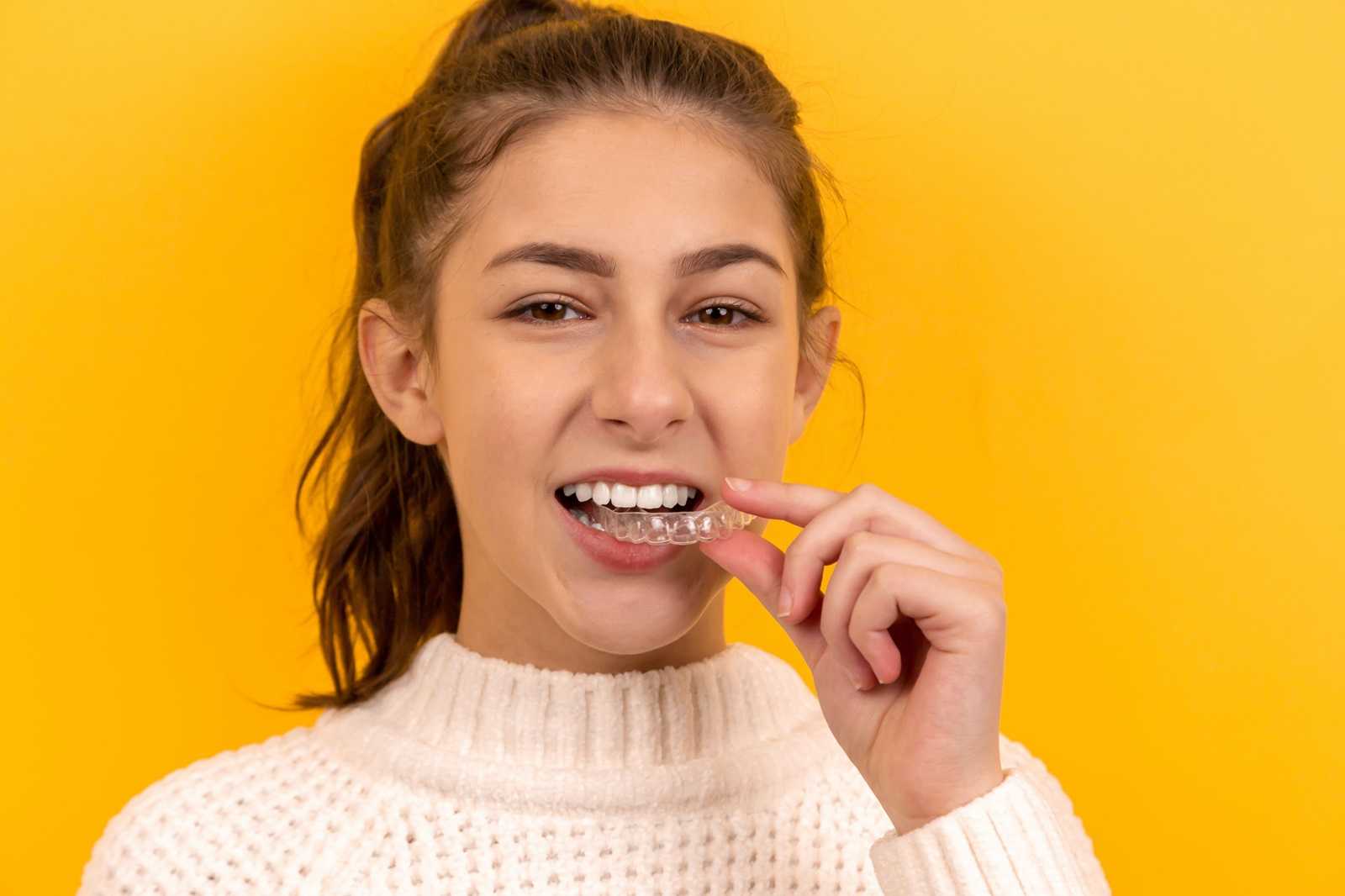 How Long Does Invisalign Take to Straighten Teeth