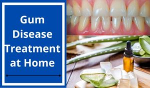 Gum Disease