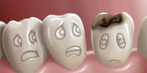 prevent-cavities
