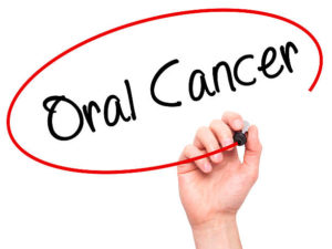 How Does Oral Cancer Start? Where Do Most Oral Cancers Occur? - D. Dental