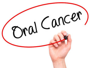 Oral cancer