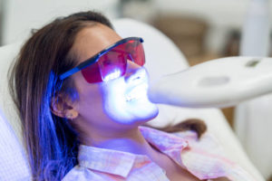 Protect Gums during Teeth Whitening