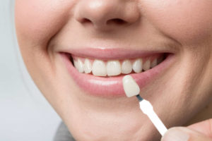 What are The Pros and Cons of Dental Veneers?