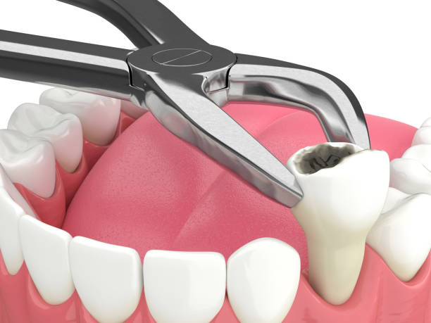 How Can Tooth Decay and Gum Disease Be Prevented?