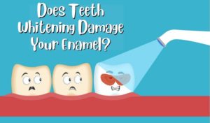 Tooth Enamel