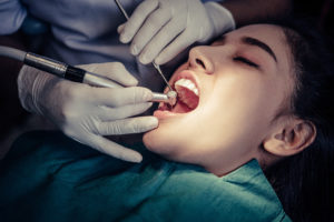 General Dentistry in The Colony