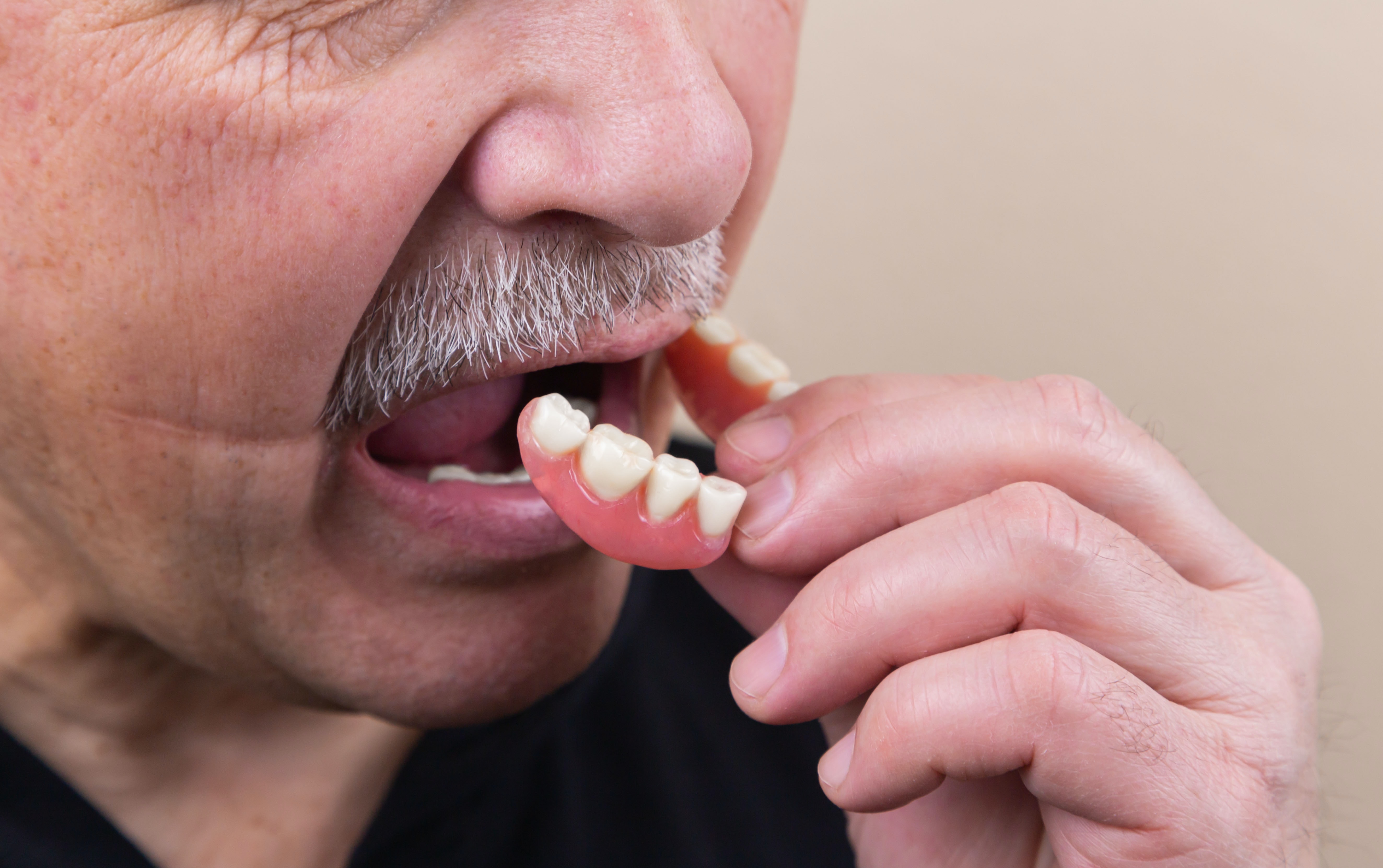 Why are Dentures so Important to Your Oral Health?