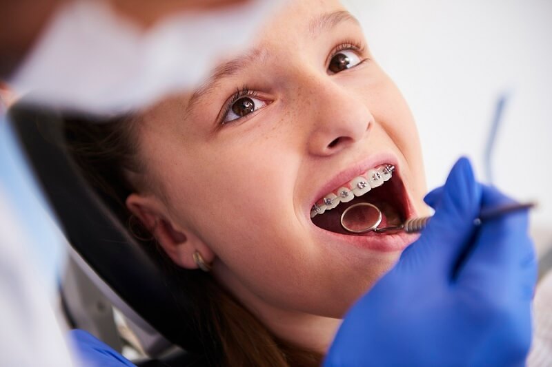 Can You Get Wisdom Teeth Pulled While Wearing Braces?