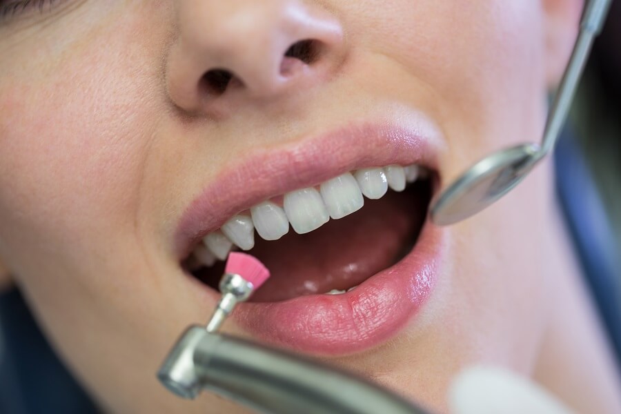 What to Expect During a General Dentistry Checkup? - D. Dental