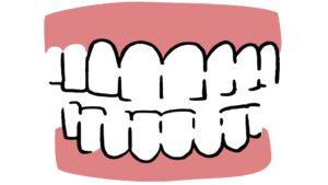 Is Teeth Movement Normal?