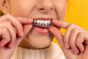 Can Braces or Invisalign Be Used on Teeth with Crowns?