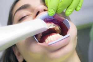 Periodontal Treatment